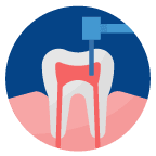 Icon-Root-Canal Icon-Root-Canal